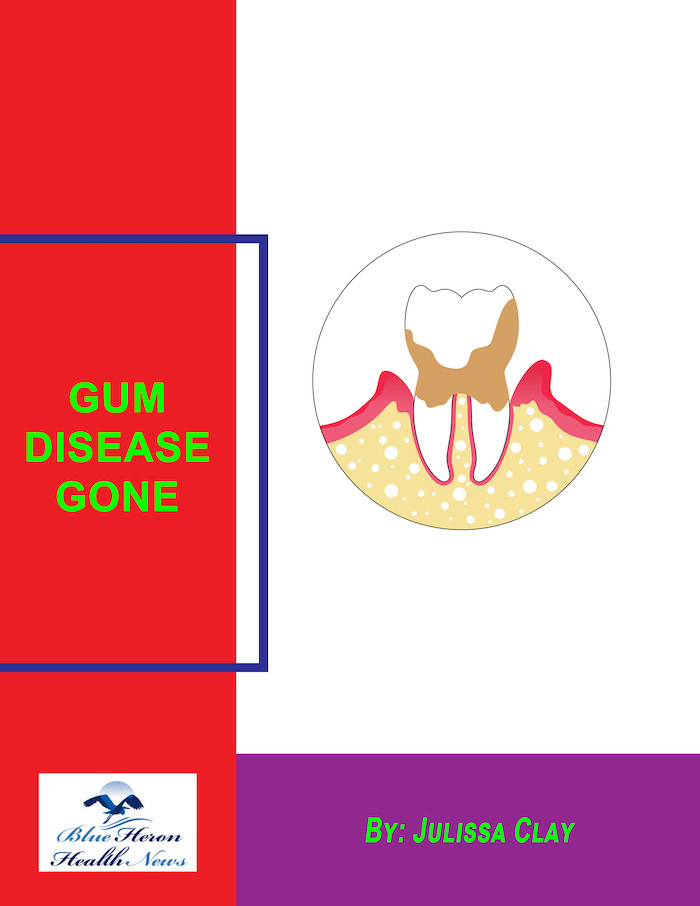 Gum Disease Gone PDF eBook Download by Julissa Clay